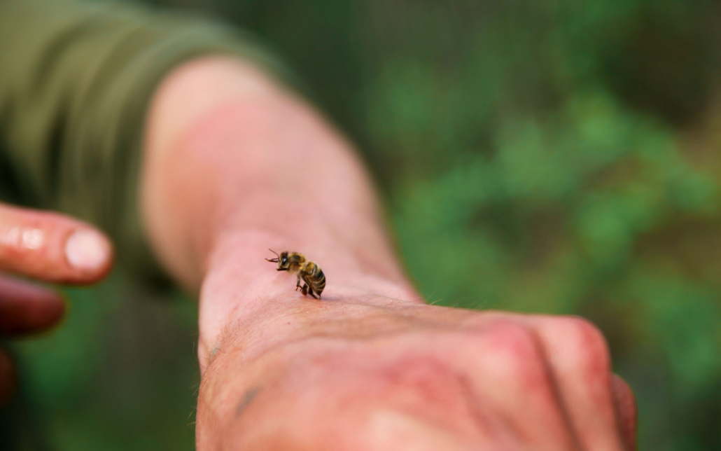 Image of a person being stung by a bee with a green background.